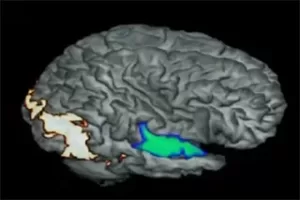 Picture of a brain with certain centers lit up demonstrating brain activity